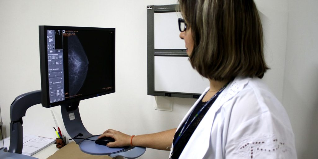planos-devem-estimular-mamografias-para-receber-atestado-de-qualidade
